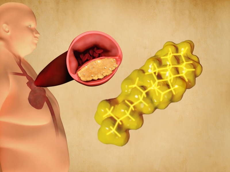 Omega-3 Có Giúp Làm Chậm Tiến Trình Xơ Vữa Động Mạch? 